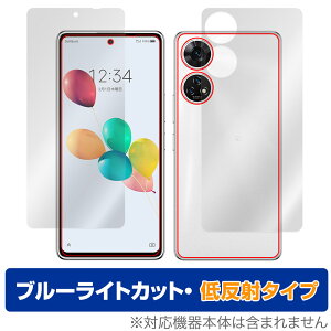 񂵂t@~[X}z / ݂R炵X}z \ w Zbg یtB OverLay Eye Protector ᔽ u[CgJbg