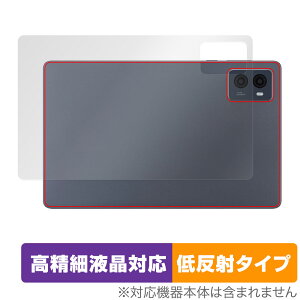 LAVIE Tab T9 T0995/HAS / TAB09/Q01 w ی tB OverLay Plus Lite B ^u T0995HAS TAB09Q01 炳G ᔽ