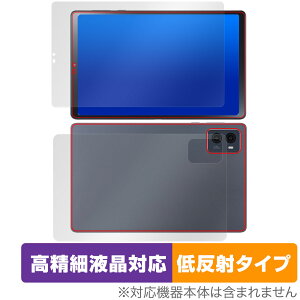 LAVIE Tab T9 T0995/HAS / TAB09/Q01 \ w tB OverLay Plus Lite \ʁEwʃZbg ׉tΉ A`OA ˖h~