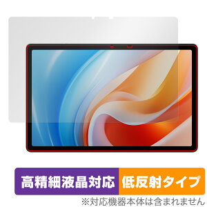 ALLDOCUBE iPlay 60 ی tB OverLay Plus Lite I[hL[u ^ubgpیtB ׉tΉ A`OA ˖h~