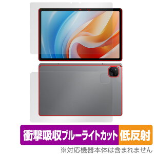 ALLDOCUBE iPlay 60 p \ w Zbg یtB OverLay Absorber ᔽ I[hL[u Ռz u[CgJbg R