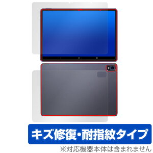 Magic Drawing Pad \ w tB OverLay Magic XPPen Android ^ubgpیtB \ʁEwʃZbg C ώw wh~