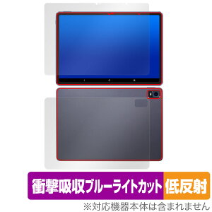Magic Drawing Pad p \ w Zbg یtB OverLay Absorber ᔽ XPPen ^ubgptB Ռz u[CgJbg