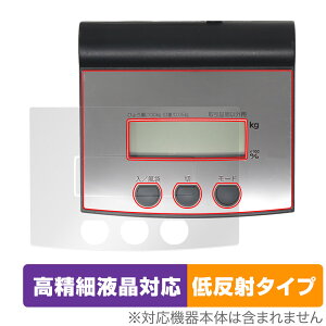 V fW^͂ 70108 یtB OverLay Plus Lite u ͂葀암ptB ׉tΉ A`OA ᔽ