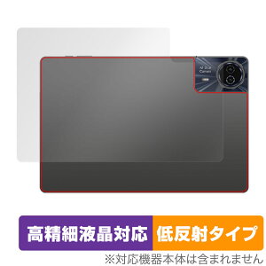 Teclast T50HD �w�� �ی� �t�B���� OverLay Plus Lite fot �e�N���X�g �^�u���b�g �{�̕ی�t�B���� ���炳���G�� �ᔽ�ˑf��