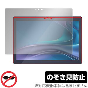 LUCA Tablet 10C` TM103M4V1-B ی tB OverLay Secret J ^ubgpیtB vCoV[tB^[ `h~