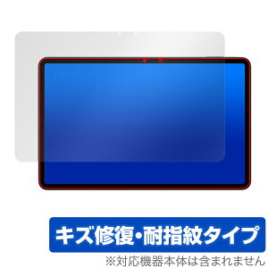 HEADWOLF HPad 6 ی tB OverLay Magic HEADWOLFHPad6 ^ubgpیtB tی C ώw wh~ R[eBO