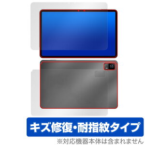 HEADWOLF HPad 6 �\�� �w�� �t�B���� OverLay Magic HEADWOLFHPad6 �^�u���b�g�p�ی�t�B���� �\�ʁE�w�ʃZ�b�g ���C�� �ώw�� �w��h�~