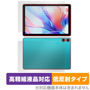 Teclast P30 �\�� �w�� �Z�b�g �ی�t�B���� OverLay Plus Lite �e�N���X�g �^�u���b�g�p�t�B���� �����׉t���Ή� �A���`�O���A ���˖h�~