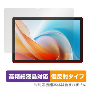 ALLDOCUBE iPlay 60 Lite ی tB OverLay Plus Lite for I[hL[u ^ubg ׉tΉ A`OA ˖h~