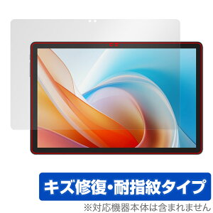 ALLDOCUBE iPlay 60 Lite ی tB OverLay Magic for I[hL[u ^ubg tی C ώw wh~ R[eBO