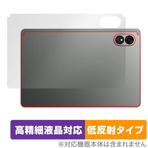 ALLDOCUBE iPlay 60 Lite w ی tB OverLay Plus Lite for I[hL[u ^ubg {̕یtB 炳G