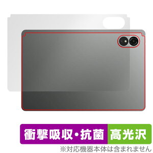 ALLDOCUBE iPlay 60 Lite w ی tB OverLay Absorber  for I[hL[u ^ubg Ռz  R