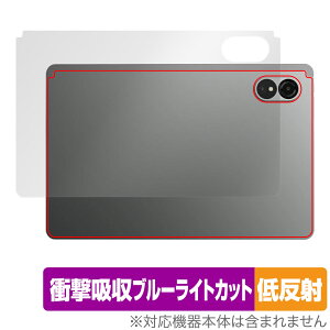 ALLDOCUBE iPlay 60 Lite w ی tB OverLay Absorber ᔽ for I[hL[u ^ubg Ռz ˖h~ R