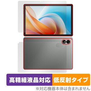 ALLDOCUBE iPlay 60 Lite \ w tB OverLay Plus Lite for I[hL[u ^ubg ׉tΉ A`OA ˖h~