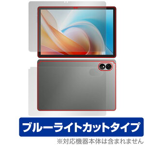 ALLDOCUBE iPlay 60 Lite \ w tB OverLay Eye Protector for I[hL[u ^ubg ڂɗD u[CgJbg