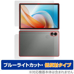 ALLDOCUBE iPlay 60 Lite \ w tB OverLay Eye Protector ᔽ for I[hL[u ^ubg u[CgJbg