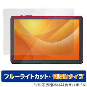 LUCA Tablet 10C` TE104M4V1-B ی tB OverLay Eye Protector ᔽ for J ^ubg u[CgJbg ˖h~