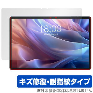 Teclast T65 Max ی tB OverLay Magic for eNXg ^ubg tی C ώw wh~ R[eBO