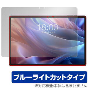 Teclast T65 Max ی tB OverLay Eye Protector for eNXg ^ubg tی ڂɗD u[CgJbg