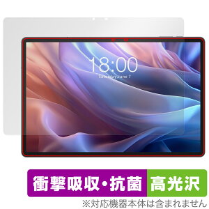 Teclast T65 Max ی tB OverLay Absorber  for eNXg ^ubg Ռz  R