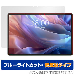 Teclast T65 Max ی tB OverLay Eye Protector ᔽ for eNXg ^ubg tی u[CgJbg ˖h~