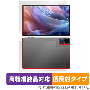 Teclast T65 Max \ w tB OverLay Plus Lite for eNXg ^ubg \ʁEwʃZbg ׉tΉ A`OA