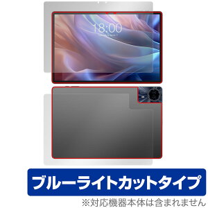 Teclast T65 Max \ w tB OverLay Eye Protector for eNXg ^ubg \ʁEwʃZbg ڂɗD u[CgJbg