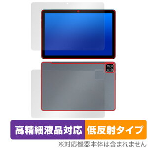 AAUW P60 \ w tB OverLay Plus Lite for A[A[ ^ubg \ʁEw ׉tΉ A`OA ˖h~ 