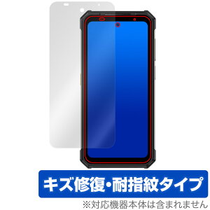Ulefone Armor 24 �ی� �t�B���� OverLay Magic for �E���t�H�� �A�[�}�[24 �t���ی� ���C�� �ώw�� �w��h�~ �R�[�e�B���O