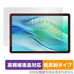 Teclast P50 �ی� �t�B���� OverLay Plus Lite for �e�N���X�g �^�u���b�g �����׉t���Ή� �A���`�O���A ���˖h�~ ����� �w��h�~