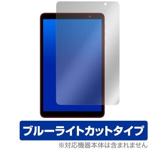 UMIDIGI G1 Tab Mini / Mini Kids ی tB OverLay Eye Protector for ~fBW ^ubg ڂɗD u[CgJbg