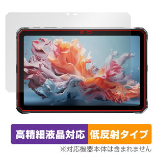 DOOGEE R20 ی tB OverLay Plus Lite for hD[W[ ^ubg ׉tΉ A`OA ˖h~  wh~