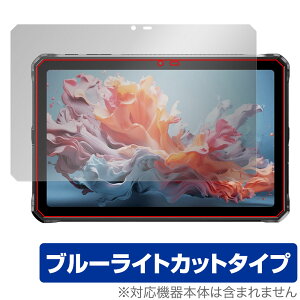 DOOGEE R20 ی tB OverLay Eye Protector for hD[W[ ^ubg tی ڂɗD u[CgJbg