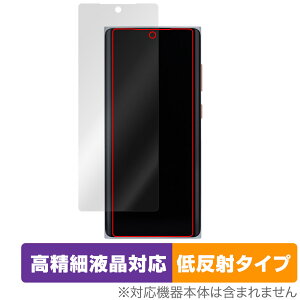 MOONDROP MIAD01 ی tB OverLay Plus Lite for J X}[gtH ׉tΉ A`OA ˖h~  wh~