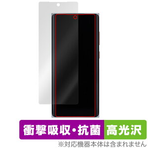 MOONDROP MIAD01 ی tB OverLay Absorber  for J X}[gtH Ռz  R