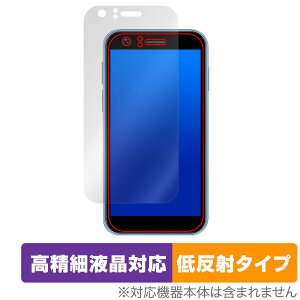 SOYES XS16 ی tB OverLay Plus Lite for ~j X}[gtH X}z ׉tΉ A`OA ˖h~  wh~