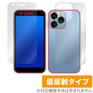 SOYES XS16 \ w tB OverLay Plus for ~j X}[gtH X}z \ʁEwʃZbg A`OA ˖h~  wh~