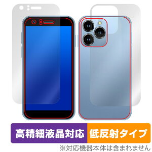 SOYES XS16 \ w tB OverLay Plus Lite for ~j X}[gtH X}z ׉tΉ A`OA ˖h~ 