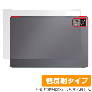 CHUWI HiPad 11 w ی tB OverLay Plus for c[EFC ^ubg {̕یtB 炳G ᔽˑf