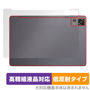 CHUWI HiPad 11 w ی tB OverLay Plus Lite for c[EFC ^ubg {̕یtB 炳G ᔽˑf