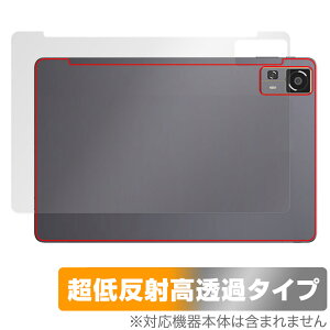 CHUWI HiPad 11 w ی tB OverLay Plus Premium for c[EFC ^ubg {̕یtB 炳G ᔽˑf