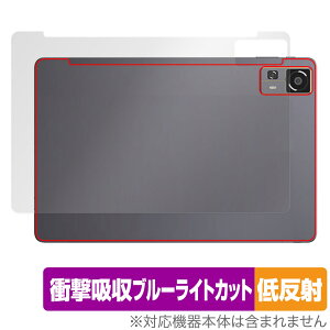 CHUWI HiPad 11 w ی tB OverLay Absorber ᔽ for c[EFC ^ubg Ռz ˖h~ R