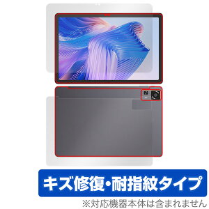 CHUWI HiPad 11 \ w tB OverLay Magic for c[EFC ^ubg \ʁEwʃZbg C ώw wh~ R[eBO