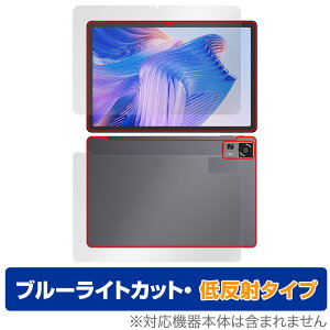 CHUWI HiPad 11 \ w tB OverLay Eye Protector ᔽ for c[EFC ^ubg \ʁEw u[CgJbg ˖h~