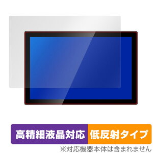 Jhcztrk 10.1C` oCj^[ HD-101 ی tB OverLay Plus Lite for Jhcztrk HD-101 ׉tΉ A`OA ᔽ