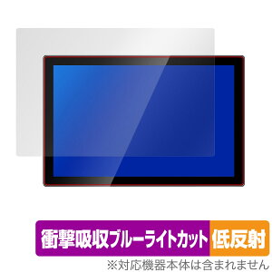 Jhcztrk 10.1C` oCj^[ HD-101 ی tB OverLay Absorber ᔽ for Jhcztrk HD-101 Ռz u[CgJbg