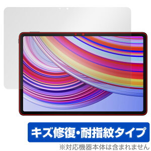 Xiaomi Redmi Pad Pro ی tB OverLay Magic for VI~[ h~ pbh v tی C ώw wh~ R[eBO