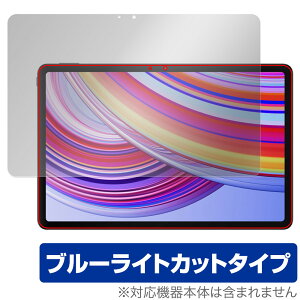 Xiaomi Redmi Pad Pro ی tB OverLay Eye Protector for VI~[ h~ pbh v tی ڂɗD u[CgJbg