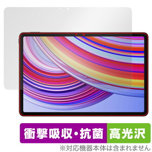 Xiaomi Redmi Pad Pro ی tB OverLay Absorber  for VI~[ h~ pbh v Ռz 